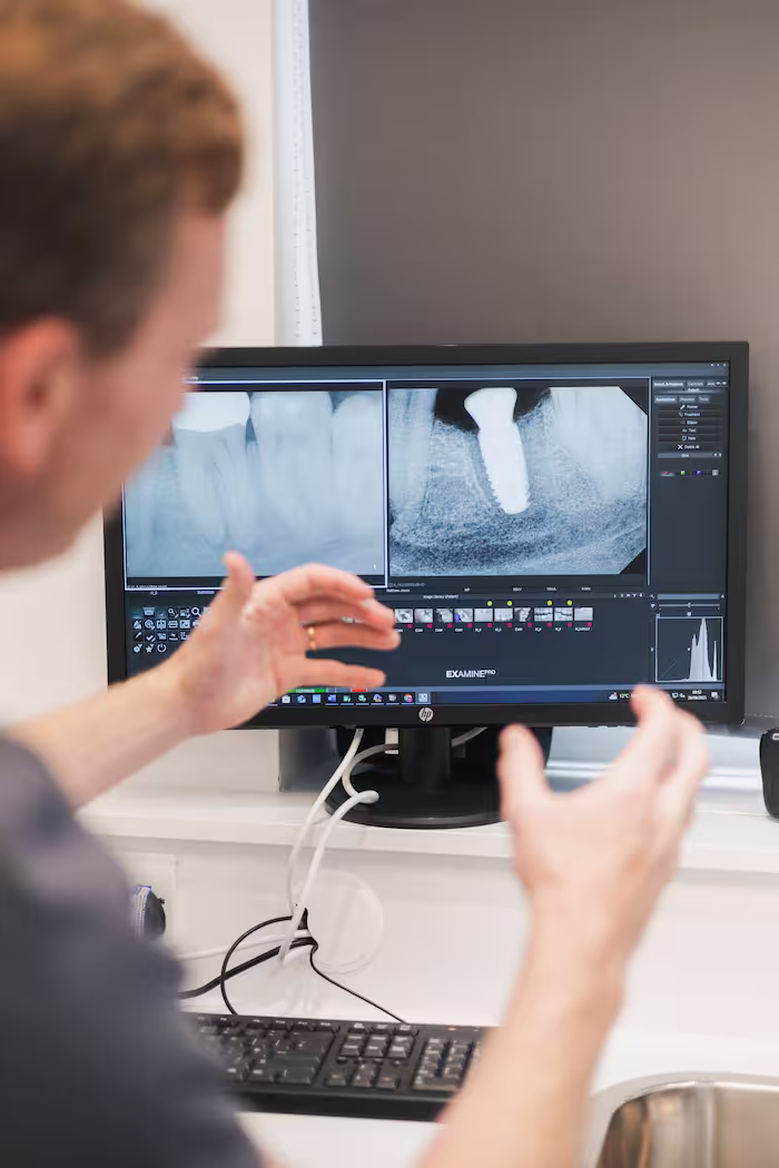 Professional teeth whitening at Forever Dental and Skin